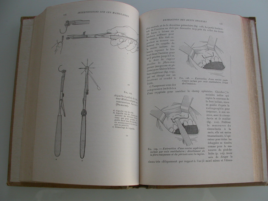 Chompret ea: Technique chirurgicale bucco-dentaire